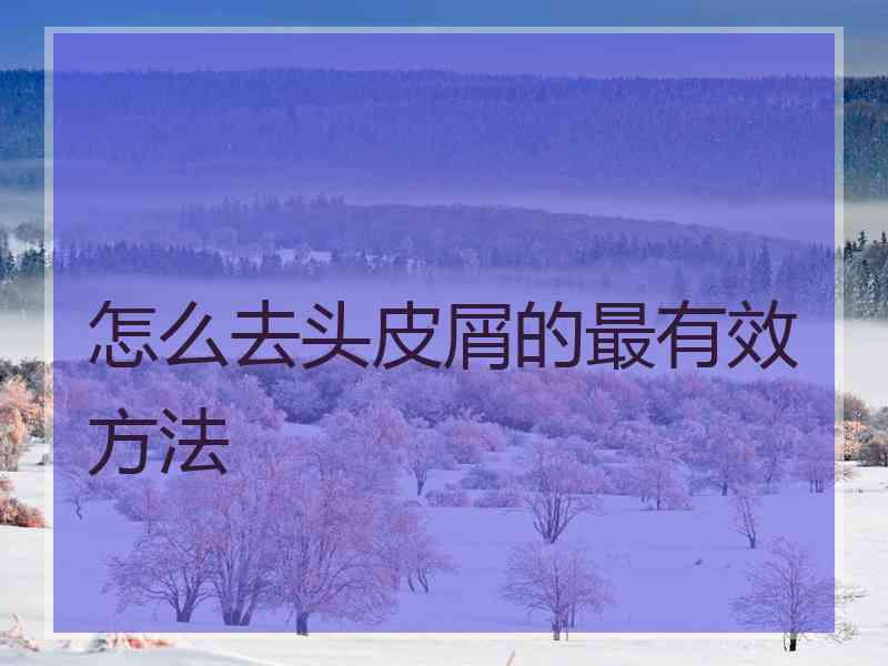 怎么去头皮屑的最有效方法