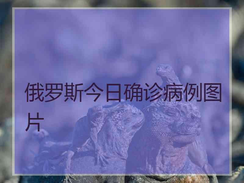 俄罗斯今日确诊病例图片